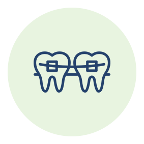 Ortodonzia trasparente